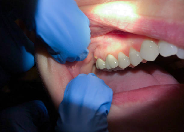 Best Teeth Whitening  in Pampa, TX